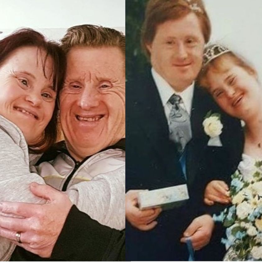 Couple With Down Syndrome Despite All The Hate They Lived Happily Together, Until Things Took a Sad Turn…